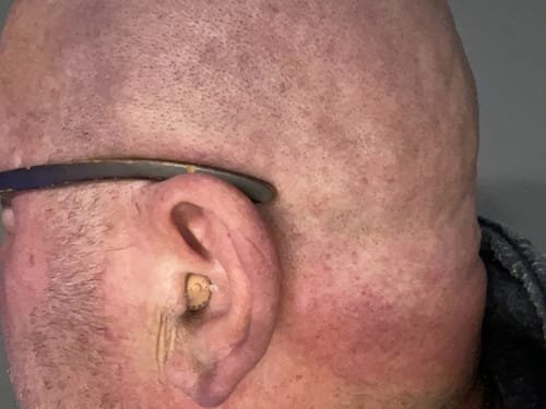 Customer photo review of Modern Hearing Comfort Hearing Aids