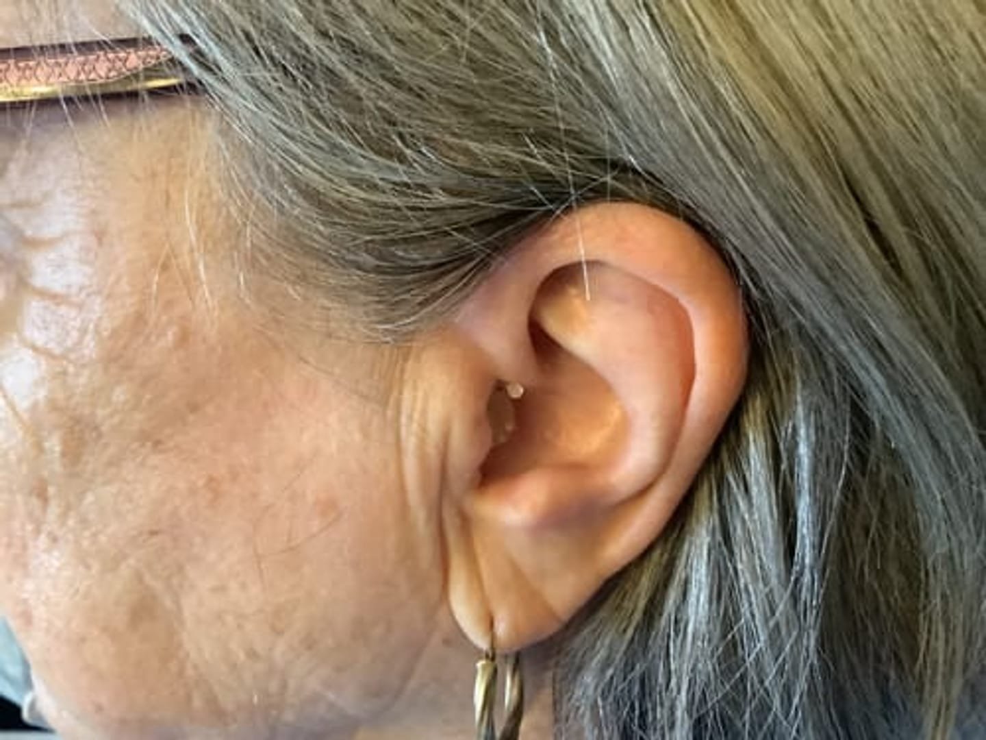 Customer photo review of Modern Hearing Comfort Hearing Aids